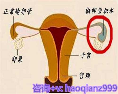 供卵在国外合法吗_供卵是三代试管吗,[湘潭正规生殖医院在哪里]湘潭正规生殖