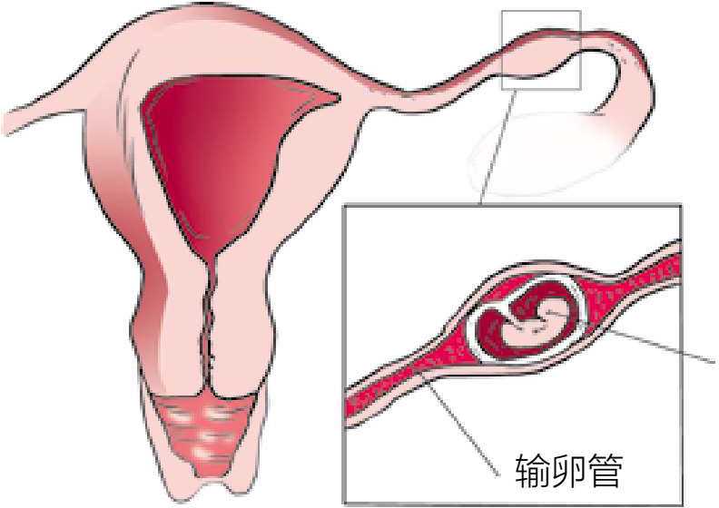 〔宝宝口腔问题挂什么科室〕,精子质量怎样才算好,什么情况下要做试管婴儿