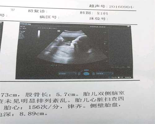 输卵管过长怎么手术多少钱,代孕一胎三胞北京代