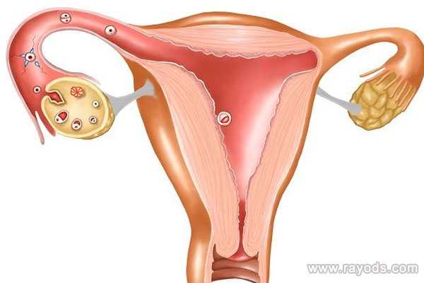 月经和排卵期出血区别主要从4个方面来分辨